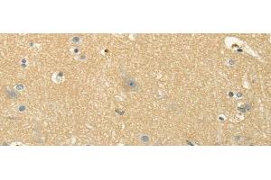Immunohistochemistry of paraffin-embedded Human brain using MSI1 Polyclonal Antibody at dilution of 1/30