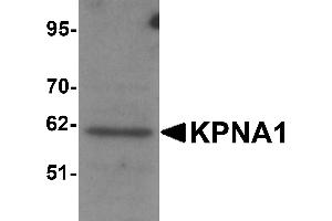 Western Blotting (WB) image for anti-Karyopherin alpha 1 (Importin alpha 5) (KPNA1) (N-Term) antibody (ABIN1031429) (KPNA1 anticorps  (N-Term))