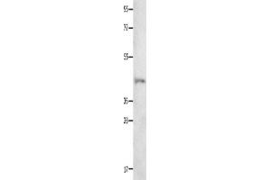 Western Blotting (WB) image for anti-Neurotensin Receptor 1 (High Affinity) (NTSR1) antibody (ABIN2426287) (NTSR1 anticorps)