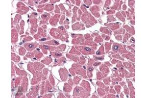 ABIN184640 (3. (ABTB1 anticorps  (C-Term))