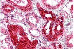 anti-GM2 Ganglioside Activator (GM2A) (N-Term) antibody