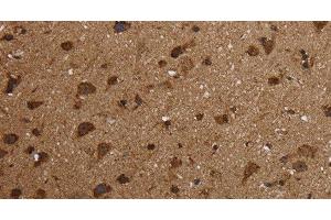 Immunohistochemistry of paraffin-embedded Human brain using HSD17B13 Polyclonal Antibody at dilution of 1:30 (HSD17B13 anticorps)