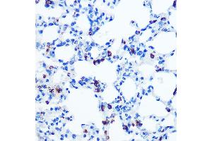 Immunohistochemistry of paraffin-embedded rat lung using GM130 Rabbit mAb (ABIN7267494) at dilution of 1:100 (40x lens).