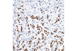 Immunohistochemistry (IHC) image for anti-Progesterone Receptor (PGR) antibody (ABIN7455133) (Progesterone Receptor anticorps)