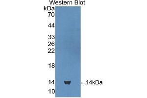 Western blot analysis of the recombinant protein. (CUBN anticorps  (AA 3511-3623))