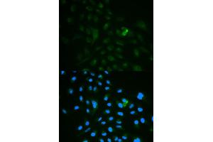 Immunofluorescence analysis of MCF7 cell using CD79B antibody. (CD79b anticorps)