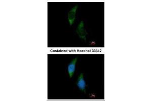 ICC/IF Image Immunofluorescence analysis of methanol-fixed HeLa, using FARSLA, antibody at 1:200 dilution. (Phenylalanyl-tRNA Synthetase, alpha Subunit (FARSA) anticorps)