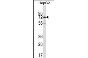 CTPS2 Antibody (C-term) (ABIN656954 and ABIN2846140) western blot analysis in HepG2 cell line lysates (35 μg/lane). (CTPS2 anticorps  (C-Term))