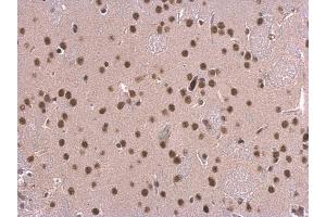 IHC-P Image SNRPD2 antibody detects SNRPD2 protein at nucleus on mouse fore brain by immunohistochemical analysis.