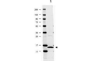 Image no. 2 for anti-Interleukin 17A (IL17A) antibody (ABIN401113) (Interleukin 17a anticorps)