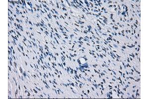 Immunohistochemical staining of paraffin-embedded colon tissue using anti-RNF144Bmouse monoclonal antibody. (RNF144B anticorps  (AA 1-256))
