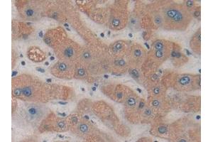 DAB staining on IHC-P; Samples: Human Liver Tissue (HDC anticorps  (AA 160-369))