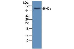 Detection of LIPC in Human Liver Tissue using Polyclonal Antibody to Lipase, Hepatic (LIPC)