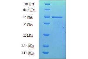 SDS-PAGE (SDS) image for Paraneoplastic Antigen MA2 (PNMA2) (AA 2-263), (partial) protein (His tag) (ABIN5710121)