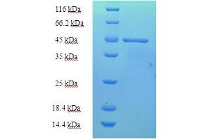 SDS-PAGE (SDS) image for Paraneoplastic Antigen MA2 (PNMA2) (AA 2-263), (partial) protein (His tag) (ABIN5710121)