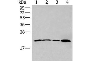 Western blot analysis of 231 cell Human breast cancer tissue Raji cell Human fetal liver tissue lysates using IFNA5 Polyclonal Antibody at dilution of 1:400 (IFNA5 anticorps)