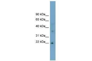 anti-Low Density Lipoprotein Receptor Class A Domain Containing 1 (LDLRAD1) (Middle Region) antibody