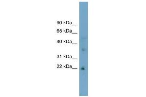 WB Suggested Anti-LDLRAD1 Antibody Titration:  0. (LDLRAD1 anticorps  (Middle Region))