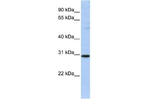 WB Suggested Anti-RAB26 Antibody Titration: 0.