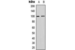 Western blot analysis of CD167a expression in Jurkat (A), rat muscle (B) whole cell lysates. (DDR1 anticorps  (C-Term))