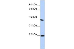 WB Suggested Anti-PSMB2 Antibody Titration: 0.