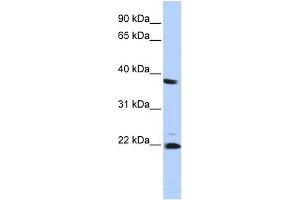 WB Suggested Anti-PSMB2 Antibody Titration: 0. (PSMB2 anticorps  (Middle Region))