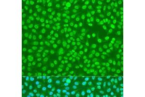 Immunofluorescence analysis of U2OS cells using HNRNPDL Polyclonal Antibody at dilution of 1:100. (HNRPDL anticorps)