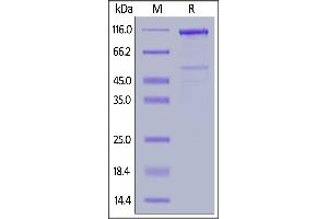 Human LRP-6 (20-630), Mouse IgG2a Fc Tag on  under reducing (R) condition.