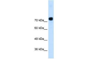 WB Suggested Anti-ACTN4 Antibody Titration:  0. (alpha Actinin 4 anticorps  (N-Term))