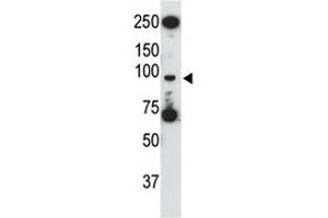 TLR5 antibody used in western blot to detect TLR5 in HL-60 cell lysate (TLR5 anticorps  (AA 825-856))