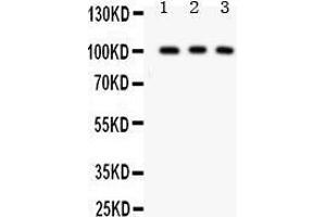 Anti- CD146 antibody, Western blotting All lanes: Anti CD146  at 0. (MCAM anticorps  (AA 59-401))