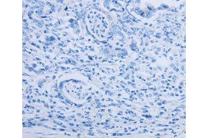 Immunohistochemistry (IHC) image for anti-Par-6 Partitioning Defective 6 Homolog alpha (PARD6A) antibody (ABIN1874031) (PARD6A anticorps)