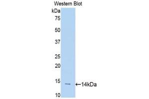 Western blot analysis of the recombinant protein. (SLIT1 anticorps  (AA 3-112))