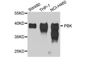Western blot analysis of extract of various cells, using SPK antibody. (Symplekin anticorps)