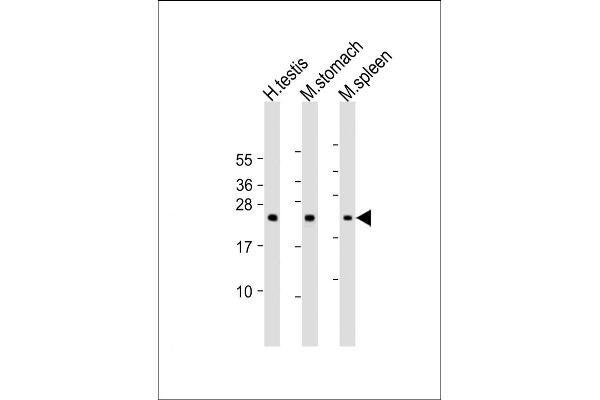 NAA40 anticorps  (AA 179-222)