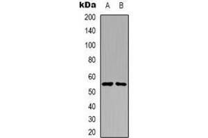 Western blot analysis of PKE expression in A431 (A), Raji (B) whole cell lysates. (STK32C anticorps)