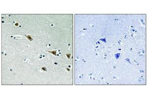 Immunohistochemical analysis of paraffin-embedded humanbrain tissue, using MAP2K7 (Phospho-Ser271) antibody (left)or the same antibody preincubated with blocking peptide (right). (MAP2K7 anticorps  (pSer271))