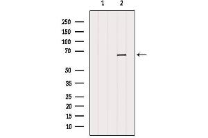 Western blot analysis of extracts from Mouse muscle, using PRPF38B Antibody. (PRPF38B anticorps  (Internal Region))