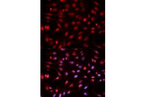 Immunofluorescence analysis of HeLa cells using APEX1 antibody. (APEX1 anticorps  (AA 1-318))