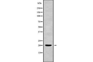 Western blot analysis of PPP3R2 using HepG2 whole cell lysates (Calcineurin B anticorps  (N-Term))