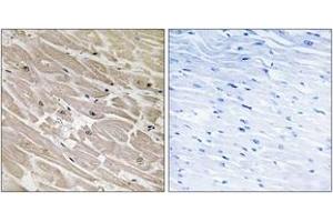 Immunohistochemistry analysis of paraffin-embedded human heart tissue, using MRPL46 Antibody.