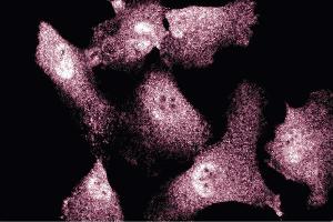 Immunofluorescent staining of Endothelial Cells