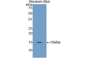 Detection of Recombinant RNASEN, Human using Polyclonal Antibody to Ribonuclease III, Nuclear (RNASEN)