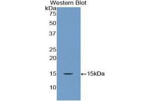 Detection of Recombinant RNASEN, Human using Polyclonal Antibody to Ribonuclease III, Nuclear (RNASEN) (DROSHA anticorps  (AA 1114-1235))