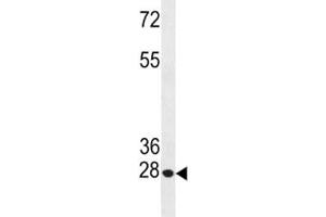 Anti-Bcl-2 antibody western blot analysis in HeLa lysate (Bcl-2 anticorps  (AA 49-76))
