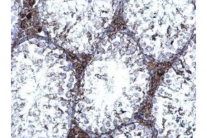 IHC-P Image TrxR1 antibody [N1N3] detects TrxR1 protein at cytoplasm on mouse testis by immunohistochemical analysis.