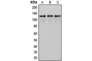Western blot analysis of ITPKB expression in HeLa (A), SP2/0 (B), H9C2 (C) whole cell lysates.