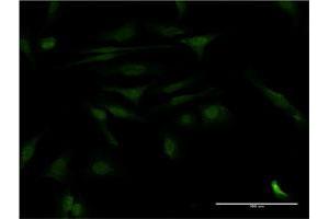 Immunofluorescence of monoclonal antibody to CALCOCO2 on HeLa cell. (CALCOCO2 anticorps  (AA 347-446))