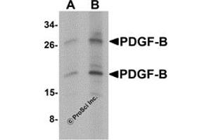 Western Blotting (WB) image for anti-Platelet Derived Growth Factor Subunit B (PDGFB) (C-Term) antibody (ABIN1077433) (PDGFB anticorps  (C-Term))