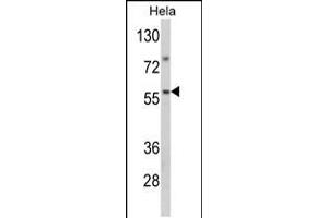 Western blot analysis of SARS2 Antibody in Hela cell line lysates (35ug/lane) (SARS2 anticorps  (AA 315-344))